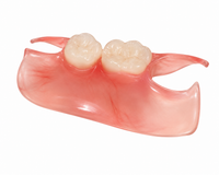 Unilateral Partial Denture