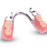 Metal Partial Denture | Custom Cast Partial Denture