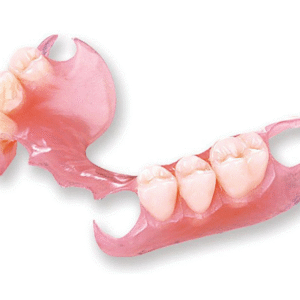 flexible-partial-denture