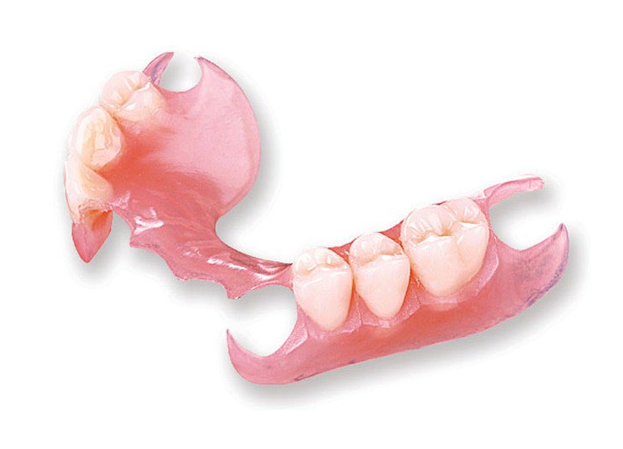 Flexible Partial Denture