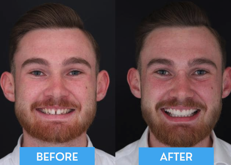 iScreen Shoter - Preview - 251004203121