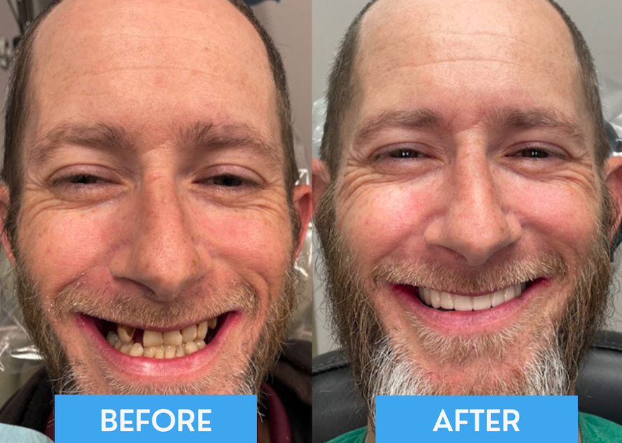 iScreen Shoter - Preview - 251004203152