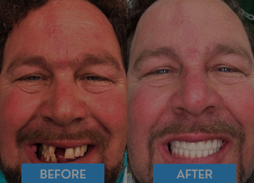 iScreen Shoter - Preview - 251004203412