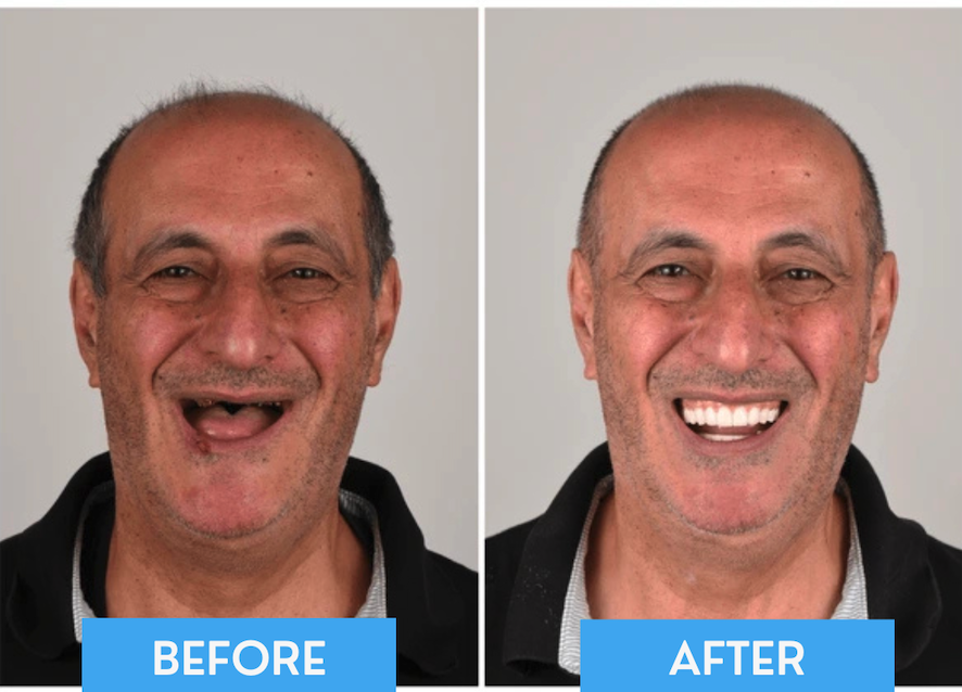 iScreen Shoter - Preview - 251004203545